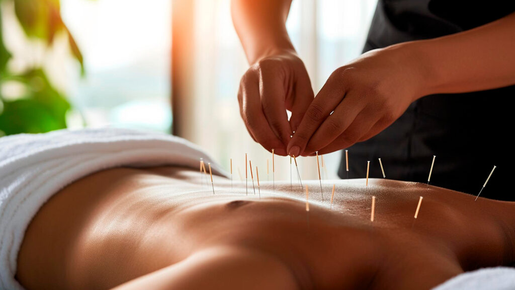 Acupuncture: A Pinpoint Solution or a Needle in the Haystack?