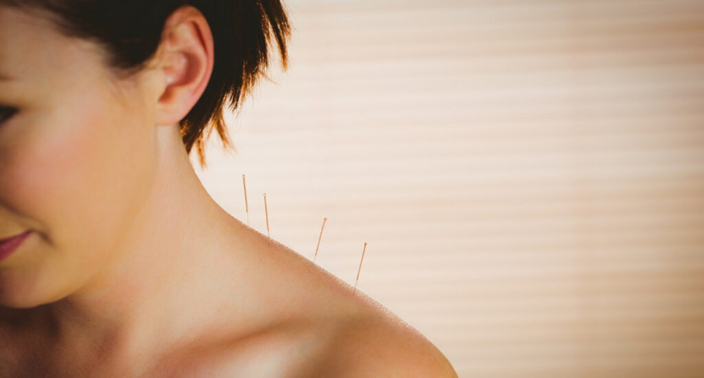 Acupuncture for Back and Neck Pain: A Drug-Free Solution