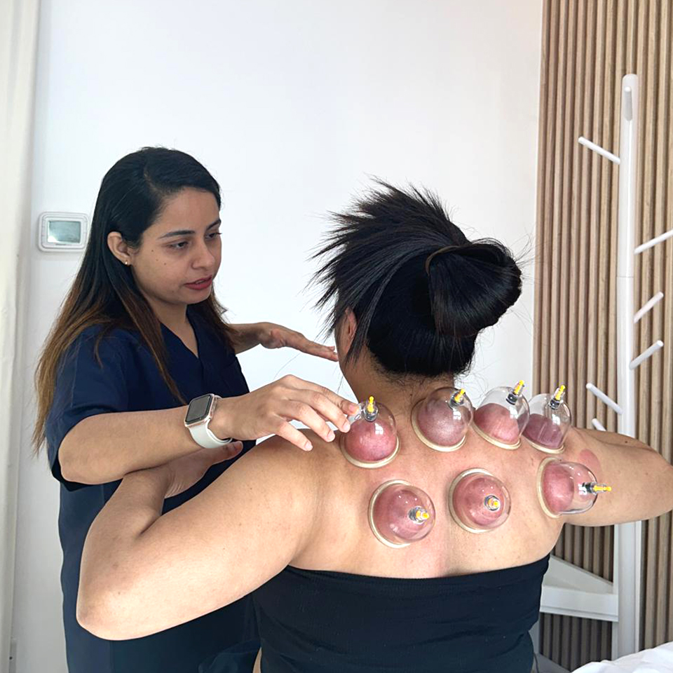 cupping and moxibustion therapy in Dubai