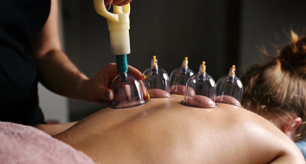 Experience Natural Healing: Cupping, Moxibustion & Hijama Therapy in Dubai 