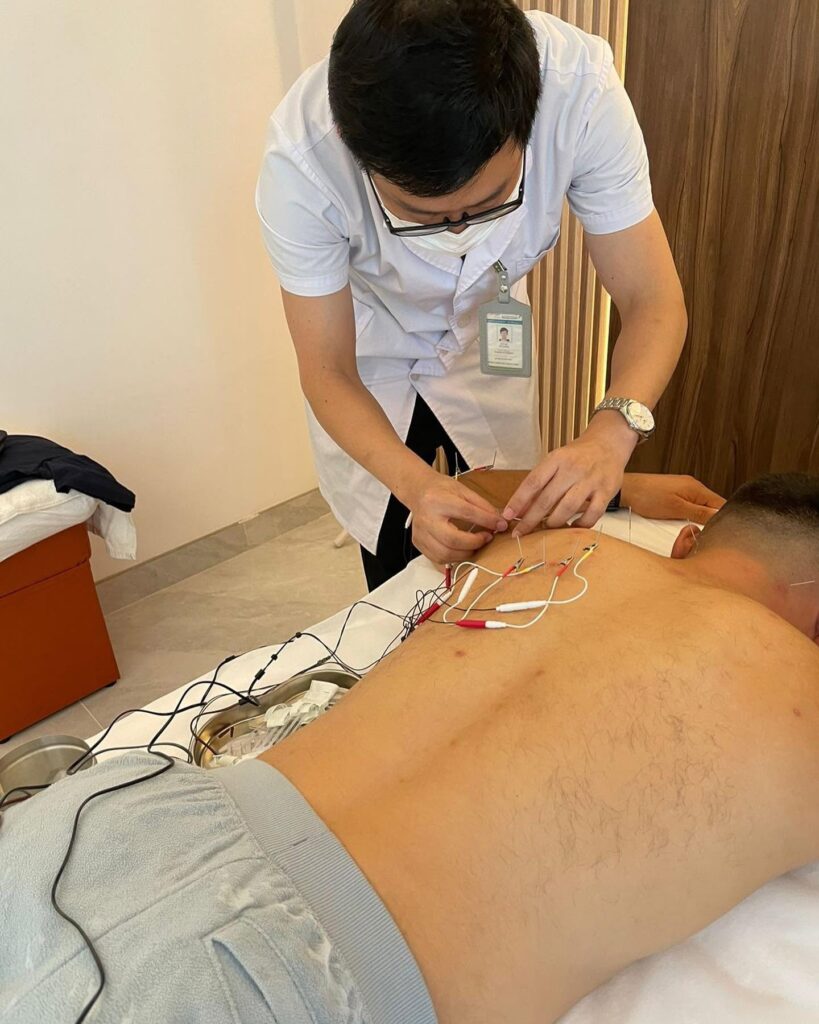 Is Acupuncture in Dubai Actually Worth It? Here’s What Nobody Tells You